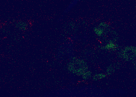 Fluorescence émise par les neurones primaires spécifiques à la douleur, entourant le noyau (rond central noir). © Jonathan Damblon / Université Laval